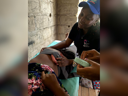 iCTG used on Tanzanian mothers